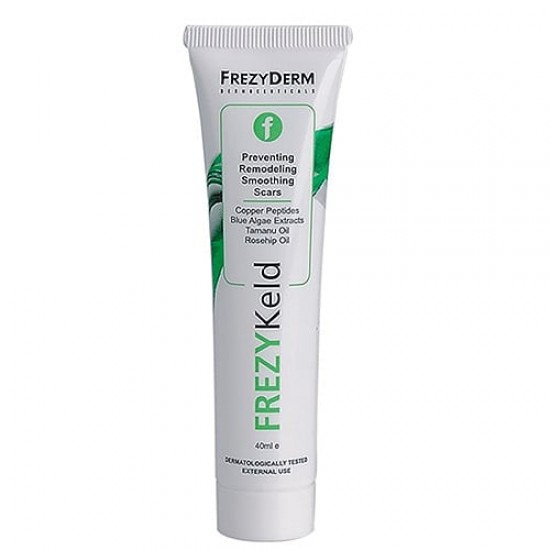 Frezyderm Frezykeld Αναπλαστική Κρέμα για τη Πρόληψη, Βελτίωση και Λείανση Ουλών, 40ml Frezyderm Frezykeld Αναπλαστική Κρέμα για τη Πρόληψη, Βελτίωση και Λείανση Ουλών, 40ml